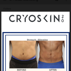 Cryo Body Spa - Our new Cryoskin 2.0! Immediate Results: Naturally Removes Fat, Tightens Skin and Eliminates Cellulite!