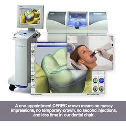 Skyline Family Dentistry - You can now watch your new crown or bridge being made and have it placed in your mouth that same day!