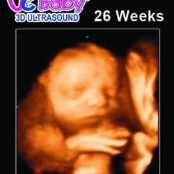 UC Baby Barrie