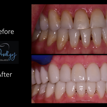 Prodigy Dental Arts - Cosmetic Dentists Near Me - Spokane Valley, Washington Prodigy Dental Arts - Cosmetic Dentists Near Me - Spokane Valley, Washington