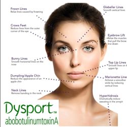 Singer Cosmetics - We carry Dysport to treat wrinkles