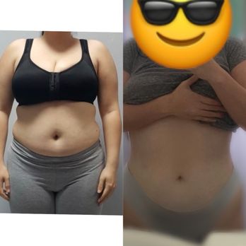 SPA After Lipo Care - Day Spas Near Me - Miami, Florida SPA After Lipo Care - Day Spas Near Me - Miami, Florida