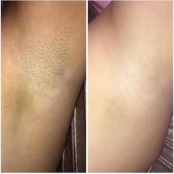 Palm Beach Laser & Aesthetic