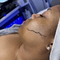 Morgan Rackley Skincare - Our "Glass Skin HydraFacial" includes Dermaplaning to remove dead skin and vellus hairs.