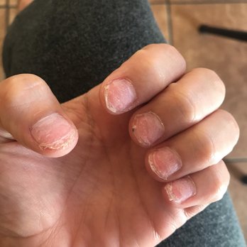 You Need Nails & Facials - This is how my nails where left when leaving - Nail Salons Near Me - Phoenix, Arizona
