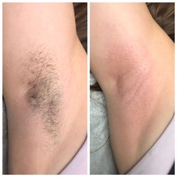 Waxing By Morgan - Underarm wax