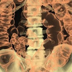 Westside Medical Imaging - Virtual Colonography with our 64-slice CT scanner