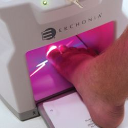 Superior Foot And Ankle Center - Erchonia nail laser in use.