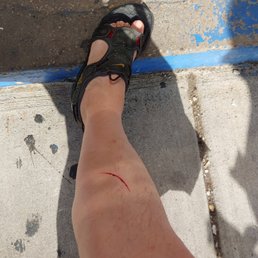 Outside Tropical Lagoon after being sliced inside on the edge of a tank left on the floor. Outside Tropical Lagoon after being sliced inside on the edge of a tank left on the floor.