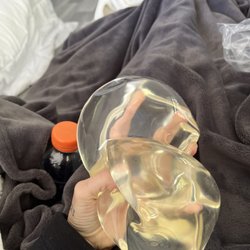 Austin Plastic Surgery Center - The silicone implants that Dr Maggi put in, I had them removed on 5/13/2022