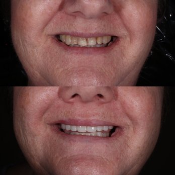 Just Smile Dental - Cosmetic dentistry - Pediatric Dentists Near Me - Everett, Washington Just Smile Dental - Cosmetic dentistry - Pediatric Dentists Near Me - Everett, Washington