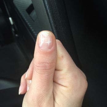 Primp & Polish - My thumbnail where the middle has lifted after two days of gel - Nail Salons Near Me - New York, New York Primp & Polish - My thumbnail where the middle has lifted after two days of gel - Nail Salons Near Me - New York, New York