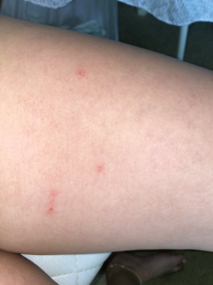 PINEWOOD GARDENS APARTMENTS Updated September 2024 26 Photos & 34 Reviews 1731 E Little