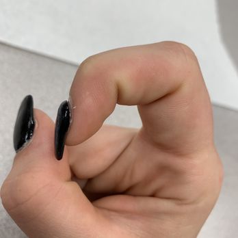 Vip Nails Spa - Nail is lifting after 10 days - Nail Salons Near Me - Bloomington, Indiana Vip Nails Spa - Nail is lifting after 10 days - Nail Salons Near Me - Bloomington, Indiana