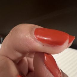 Cuticles bled from how much "dead" skin he kept chipping away at Cuticles bled from how much "dead" skin he kept chipping away at