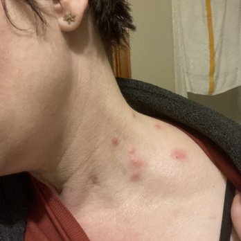 Silver Surf Motel - Bed Bugs!!! - Hotels Near Me - Yachats, Oregon Silver Surf Motel - Bed Bugs!!! - Hotels Near Me - Yachats, Oregon