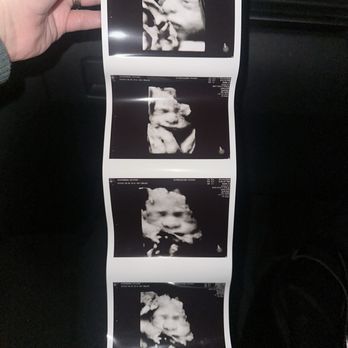 Ultrasound Studio - Ultrasound Imaging Centers Near Me - Covina, California Ultrasound Studio - Ultrasound Imaging Centers Near Me - Covina, California