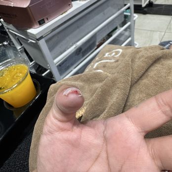 Glow Bakery & Nails - Cut on finger - Nail Salons Near Me - Ontario, California