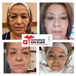 Integrum APN Clinic Family Care and Aesthetics - 1 year of Combination of therapies progress