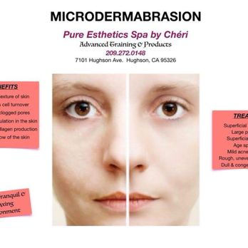 Pure Esthetics Spa - Microdermabrasion-Regular Or Organic - Day Spas Near Me - Hughson, California Pure Esthetics Spa - Microdermabrasion-Regular Or Organic - Day Spas Near Me - Hughson, California