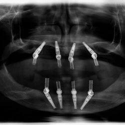 Louis Rutland III, DDS, FICOI, FAAIP, MBA