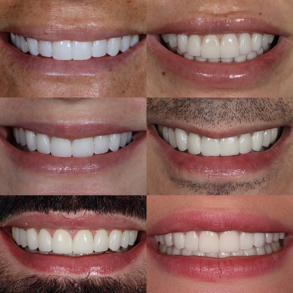 New York Center for Cosmetic Dentistry