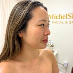 MichelSkin