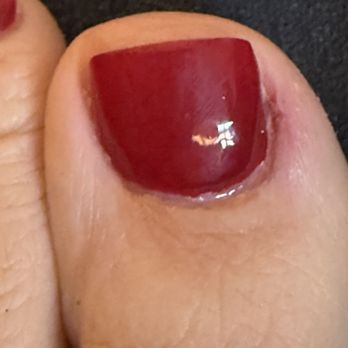 Lush Nail Bar - Completely torn up cuticle and STILL a ton of acrylic on the outer skin. - Nail Salons Near Me - Madison, Alabama Lush Nail Bar - Completely torn up cuticle and STILL a ton of acrylic on the outer skin. - Nail Salons Near Me - Madison, Alabama