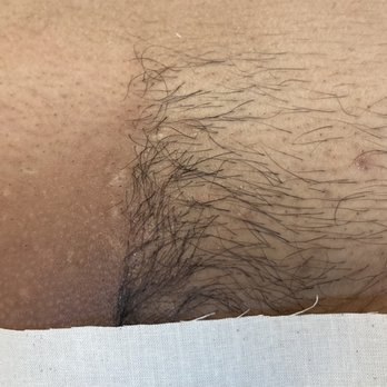 Bare Beauty By Brandy - Halfway through a Brazilian wax - Waxing Near Me - Chino, California Bare Beauty By Brandy - Halfway through a Brazilian wax - Waxing Near Me - Chino, California