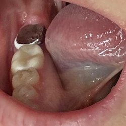Emerald Coast Smiles By Design - Example of this dentists work