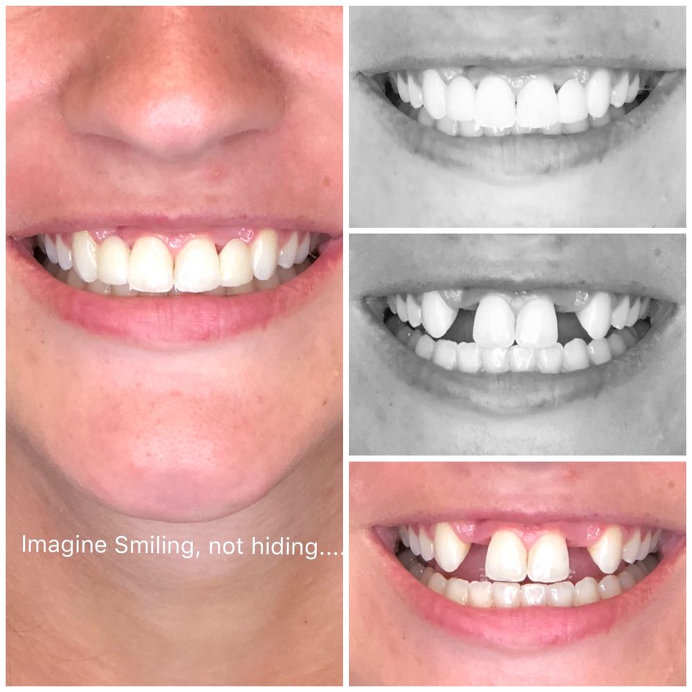 LATHROP DENTAL CENTER 18 Photos & 30 Reviews 5929 Fm 1463, Katy