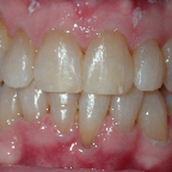 Sandy Pape, DDS - Isle Smile - After