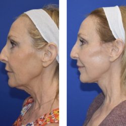 Yula Indeyeva, MD - Facial Plastic Surgery Of Austin