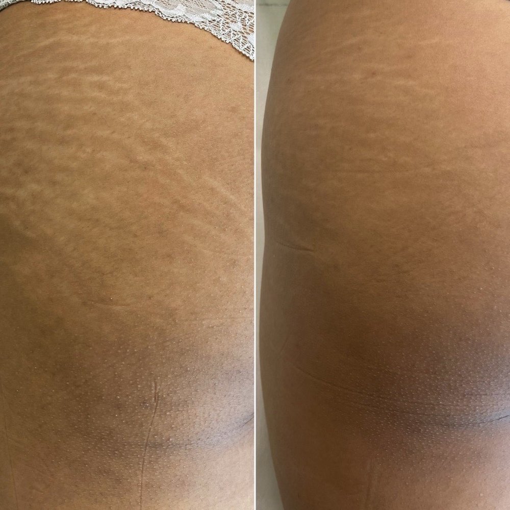 Boleyn studio - Boleyn treatment - Permanent Makeup Near Me - Beverly Hills, California Boleyn studio - Boleyn treatment - Permanent Makeup Near Me - Beverly Hills, California