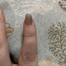 Bad nail job painful Bad nail job painful