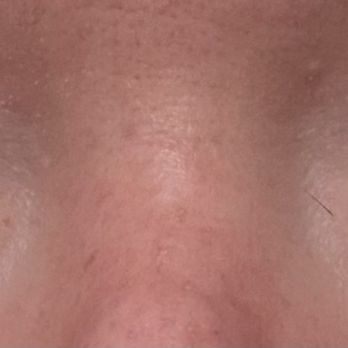 The Beauty Methods - Classic lash extensions, doll eye - Eyelash Service Near Me - San Jose, California The Beauty Methods - Classic lash extensions, doll eye - Eyelash Service Near Me - San Jose, California