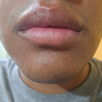 El Taco Llama Restaurant - Swollen lips - Mexican Near Me - Van Nuys, California