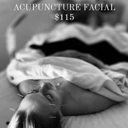 Gigi70 Skin Care - Acupuncture Facial