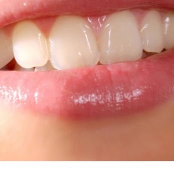 Nevada Sun Dental - So happy to smile :) - General Dentistry Near Me - Henderson, Nevada Nevada Sun Dental - So happy to smile :) - General Dentistry Near Me - Henderson, Nevada