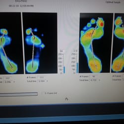 Family Foot and Ankle Center - Shermi Parikh, DPM - Foot scan to make custom orthotics or plantillas