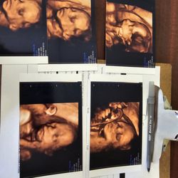 Little Toes & Fingers Ultrasound