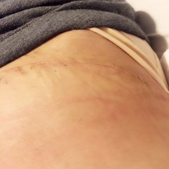 Kevin M Ruhge, MD - Cosmetic Surgeons Near Me - Pasadena, California Kevin M Ruhge, MD - Cosmetic Surgeons Near Me - Pasadena, California