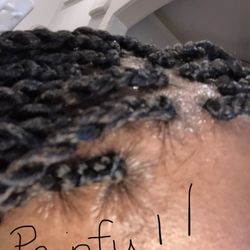 NOLABraider - The braider braided my hair too tight. I was in such pain