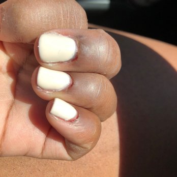 Bliss Nail - It hurts so bad!! I put alcohol on it to kill any germs I really don't want to get an infection from this place ugh! Never going back! - Nail Salons Near Me - North Wales, Pennsylvania