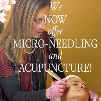 Sundhari Holistic  Spa - Microneedling services NOW available! - Massage Near Me - Berkeley, California