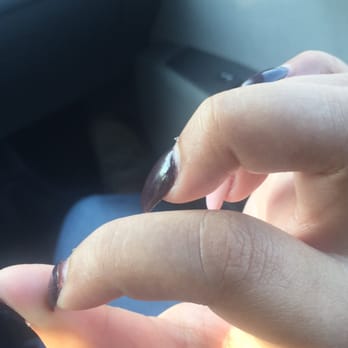Passion Nail Spa - You can see the nail is about to come completely off - Nail Salons Near Me - Germantown, Maryland Passion Nail Spa - You can see the nail is about to come completely off - Nail Salons Near Me - Germantown, Maryland