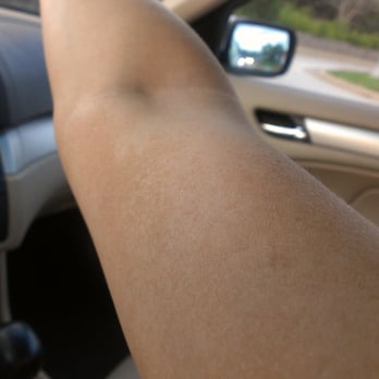 The Sinless Tan - Splotchy residue left a week later... - Spray Tanning Near Me - Chicago, Illinois