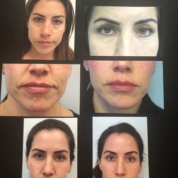 West Institute - Dermatologists Near Me - Chevy Chase, Maryland West Institute - Dermatologists Near Me - Chevy Chase, Maryland