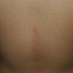 Josh Stevens Elementary School - My son's bullying injuries