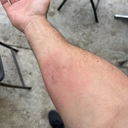 East Beach Batting Cages - 80mph machine threw one at my head, was lucky I got my face out of the way but it still caught my back arm.